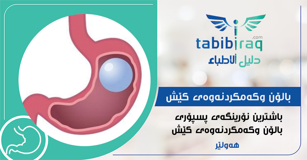 باڵۆنی گەدە - نۆرينگەی پسپۆری بالۆن وكەمكردنەوەی كێش باڵۆنی گەدە - نۆرينگەی پسپۆری بالۆن وكەمكردنەوەی كێش