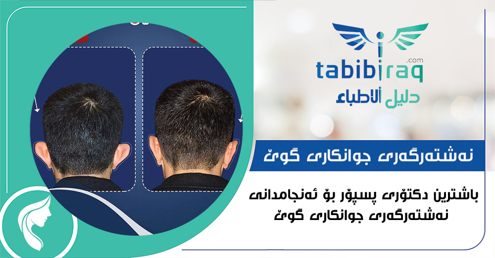 باشترین دكتۆر بۆ نهشتهگهری جوانكاری گوێ باشترین دكتۆر بۆ نهشتهگهری جوانكاری گوێ