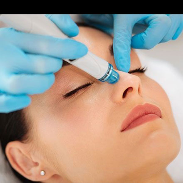 هایدرۆفهیشیهڵ هایدرۆفهیشیهڵ